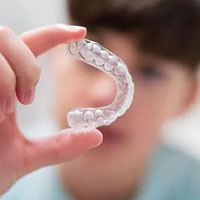 Dental-Aligners